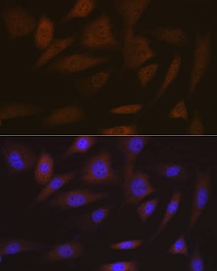 Immunocytochemistry/ Immunofluorescence: SMC4 Antibody (9Z8S3) [NBP3-16219] - Immunofluorescence analysis of NIH/3T3 cells using SMC4 Rabbit mAb  at dilution of 1:100 (40x lens). Blue: DAPI for nuclear staining.