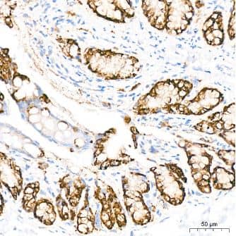 Immunohistochemistry-Paraffin: COX-2 Antibody (2V7G8) [NBP3-16220] - Analysis of COX2/PTGS2 in paraffin-embedded rat colon tissue using COX2/PTGS2 Rabbit mAb at a dilution of 1:200 (40x lens).High pressure antigen retrieval was performed with 0.01 M citrate buffer (pH 6.0) prior to IHC staining.