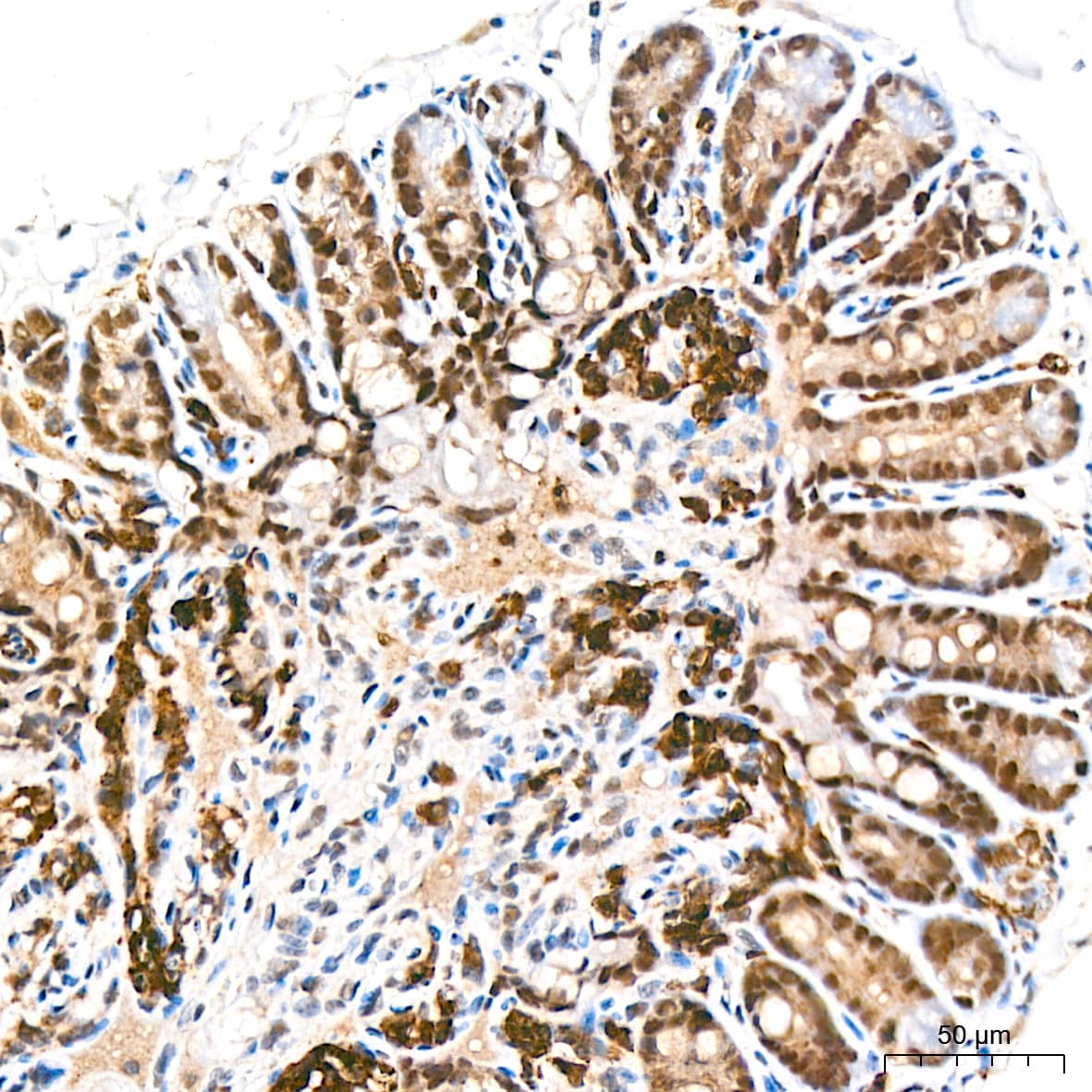 Immunohistochemistry: RCOR1/CoREST Antibody (9B3R7) [NBP3-16225] - Immunohistochemistry analysis of paraffin-embedded Mouse colon tissue using RCOR1/CoREST Rabbit mAb at a dilution of 1:200 (40x lens). High pressure antigen retrieval performed with 0.01M Tris-EDTA Buffer (pH 9.0) prior to IHC staining.