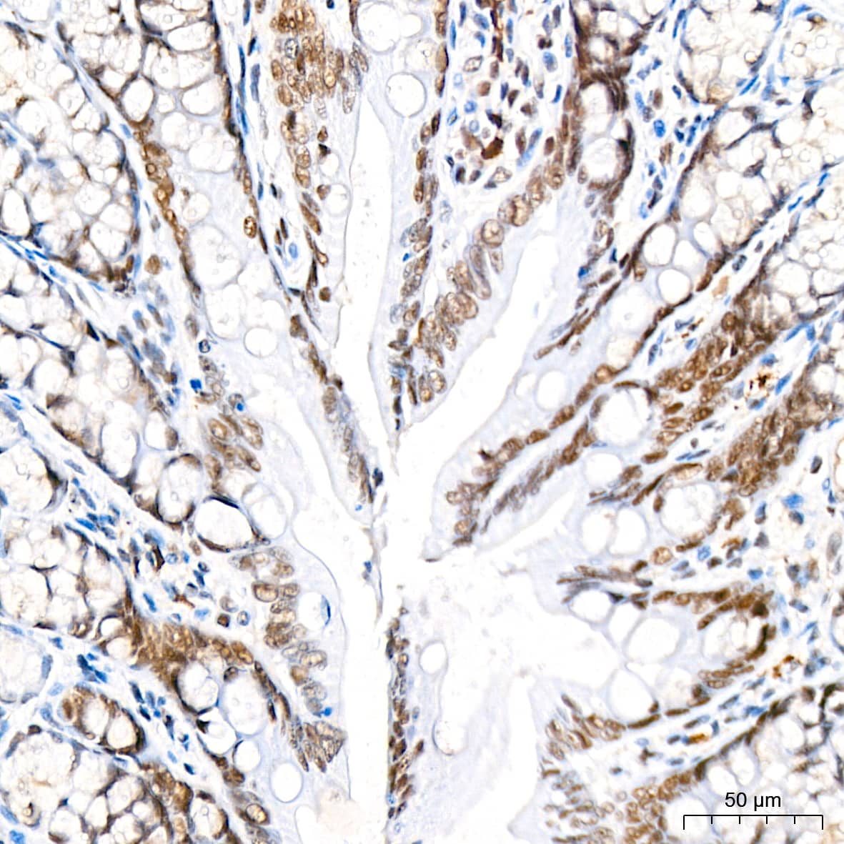 Immunohistochemistry: RCOR1/CoREST Antibody (9B3R7) [NBP3-16225] - Immunohistochemistry analysis of paraffin-embedded Rat colon tissue using RCOR1/CoREST Rabbit mAb at a dilution of 1:200 (40x lens). High pressure antigen retrieval performed with 0.01M Tris-EDTA Buffer (pH 9.0) prior to IHC staining.