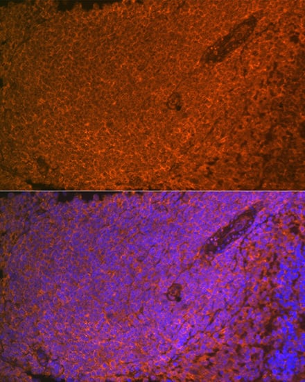 Immunocytochemistry/ Immunofluorescence: SHIP Antibody (2F8U0) [NBP3-16226] - Immunofluorescence analysis of paraffin-embedded rat spleen using SHIP1 Rabbit mAb at dilution of 1:100 (40x lens). Secondary antibody: Cy3 Goat Anti-Rabbit IgG (H+L) at 1:500 dilution. Blue: DAPI for nuclear staining.