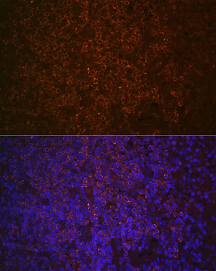 Immunocytochemistry/ Immunofluorescence: SHIP Antibody (2F8U0) [NBP3-16226] - Immunofluorescence analysis of paraffin-embedded human spleen using SHIP1 Rabbit mAb at dilution of 1:100 (40x lens). Secondary antibody: Cy3 Goat Anti-Rabbit IgG (H+L) at 1:500 dilution. Blue: DAPI for nuclear staining.