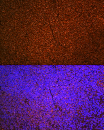 Immunocytochemistry/ Immunofluorescence: SHIP Antibody (2F8U0) [NBP3-16226] - Immunofluorescence analysis of paraffin-embedded mouse spleen using SHIP1 Rabbit mAb at dilution of 1:100 (40x lens). Secondary antibody: Cy3 Goat Anti-Rabbit IgG (H+L) at 1:500 dilution. Blue: DAPI for nuclear staining.