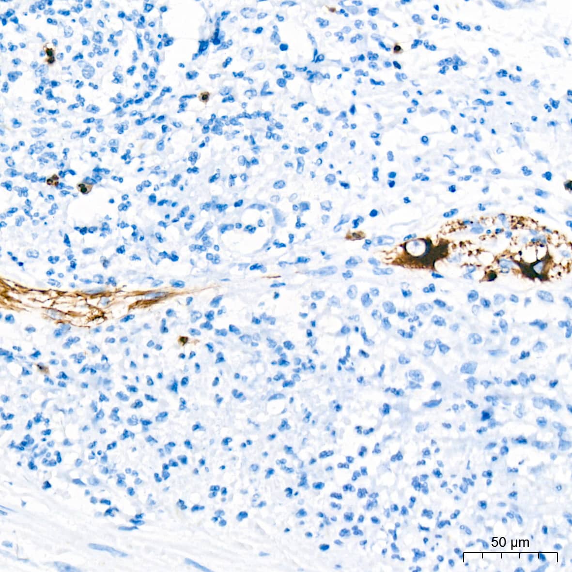 Immunohistochemistry: alpha-Internexin Antibody (5E5Z3) [NBP3-16230] - Immunohistochemistry analysis of alpha-Internexin in paraffin-embedded human appendix tissue using alpha-Internexin Rabbit mAb  at a dilution of 1:200 (40x lens). High pressure antigen retrieval was performed with 0.01 M citrate buffer (pH 6.0) prior to IHC staining.
