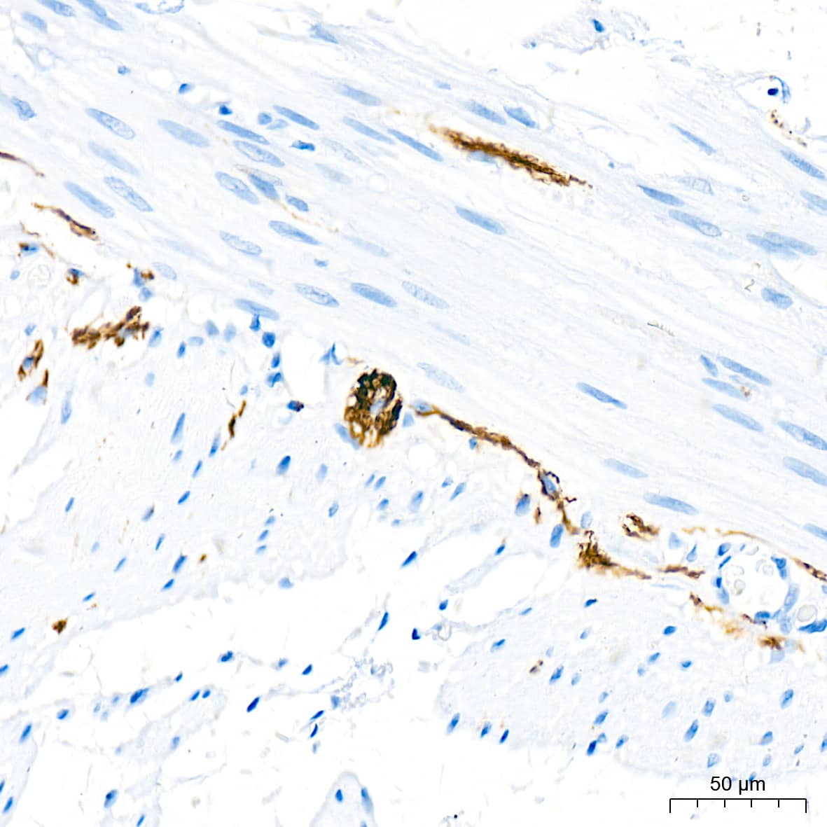 Immunohistochemistry: alpha-Internexin Antibody (5E5Z3) [NBP3-16230] - Immunohistochemistry analysis of alpha-Internexin in paraffin-embedded human colon tissue using alpha-Internexin Rabbit mAb  at a dilution of 1:200 (40x lens). High pressure antigen retrieval was performed with 0.01 M citrate buffer (pH 6.0) prior to IHC staining.