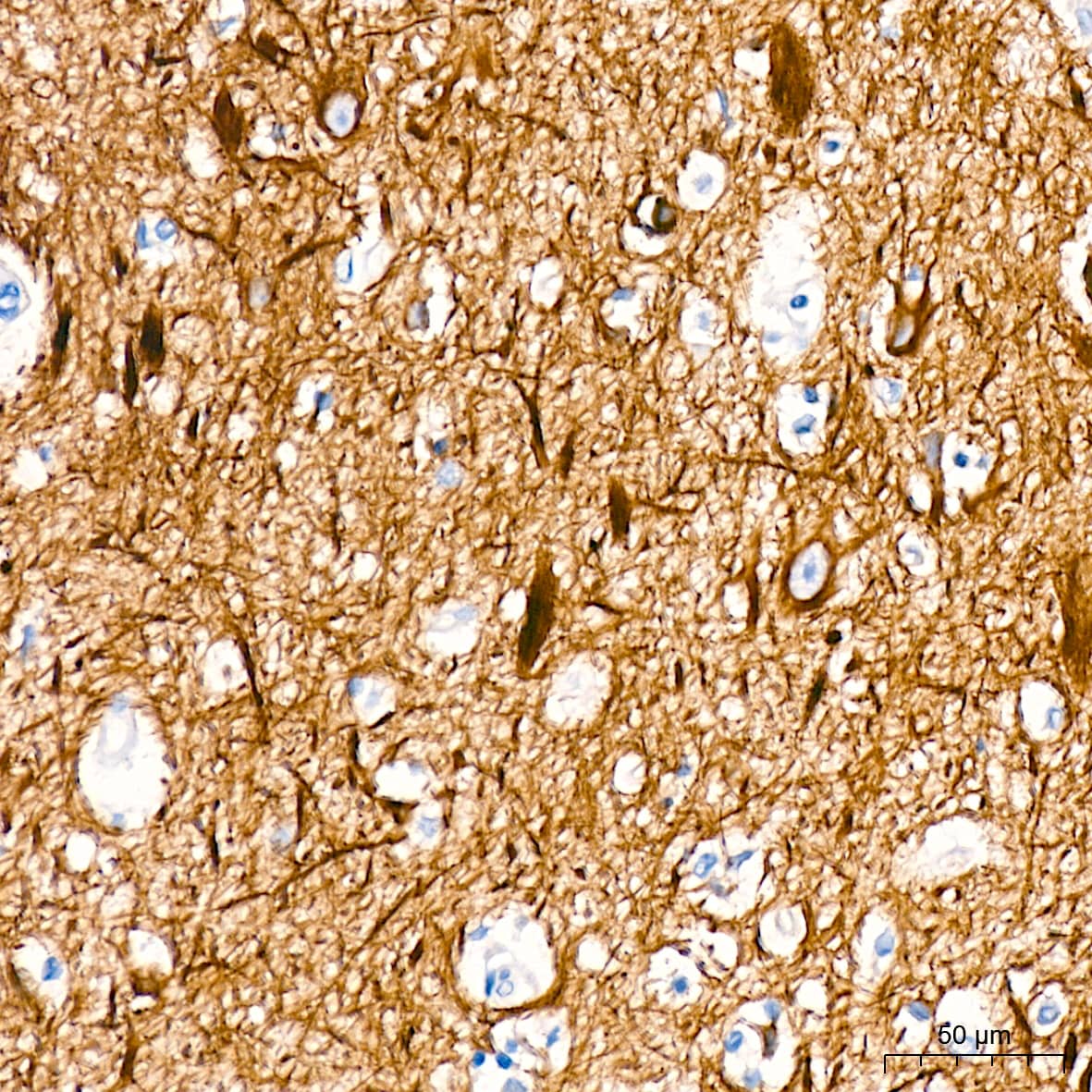 Immunohistochemistry: alpha-Internexin Antibody (5E5Z3) [NBP3-16230] - Immunohistochemistry analysis of alpha-Internexin in paraffin-embedded human brain tissue using alpha-Internexin Rabbit mAb  at a dilution of 1:200 (40x lens). High pressure antigen retrieval was performed with 0.01 M citrate buffer (pH 6.0) prior to IHC staining.