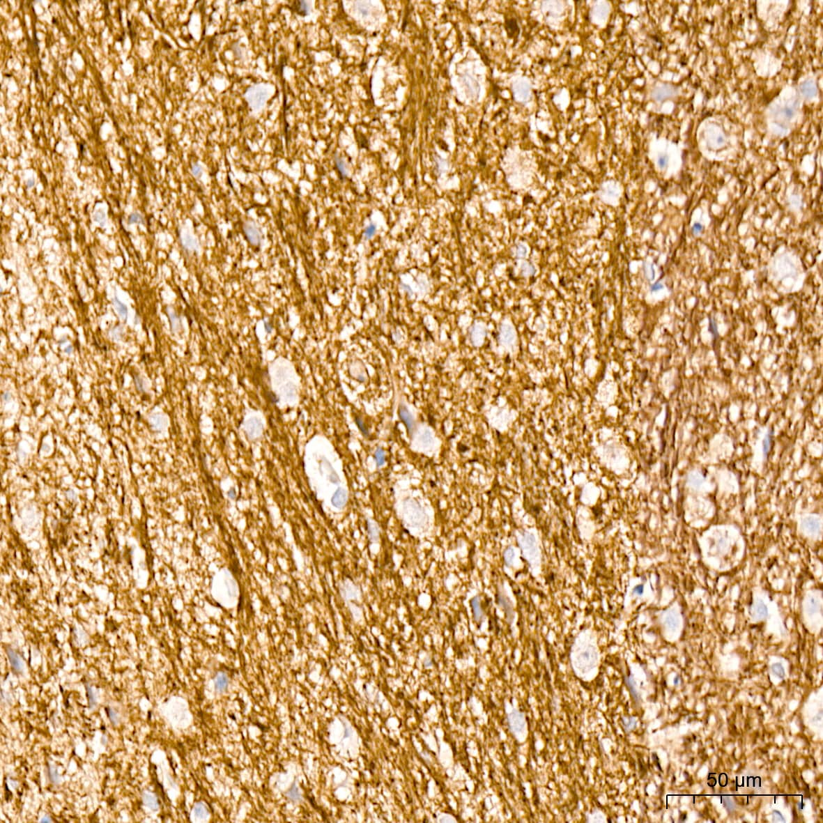 Immunohistochemistry: alpha-Internexin Antibody (5E5Z3) [NBP3-16230] - Immunohistochemistry analysis of alpha-Internexin in paraffin-embedded rat brain tissue using alpha-Internexin Rabbit mAb  at a dilution of 1:200 (40x lens). High pressure antigen retrieval was performed with 0.01 M citrate buffer (pH 6.0) prior to IHC staining.