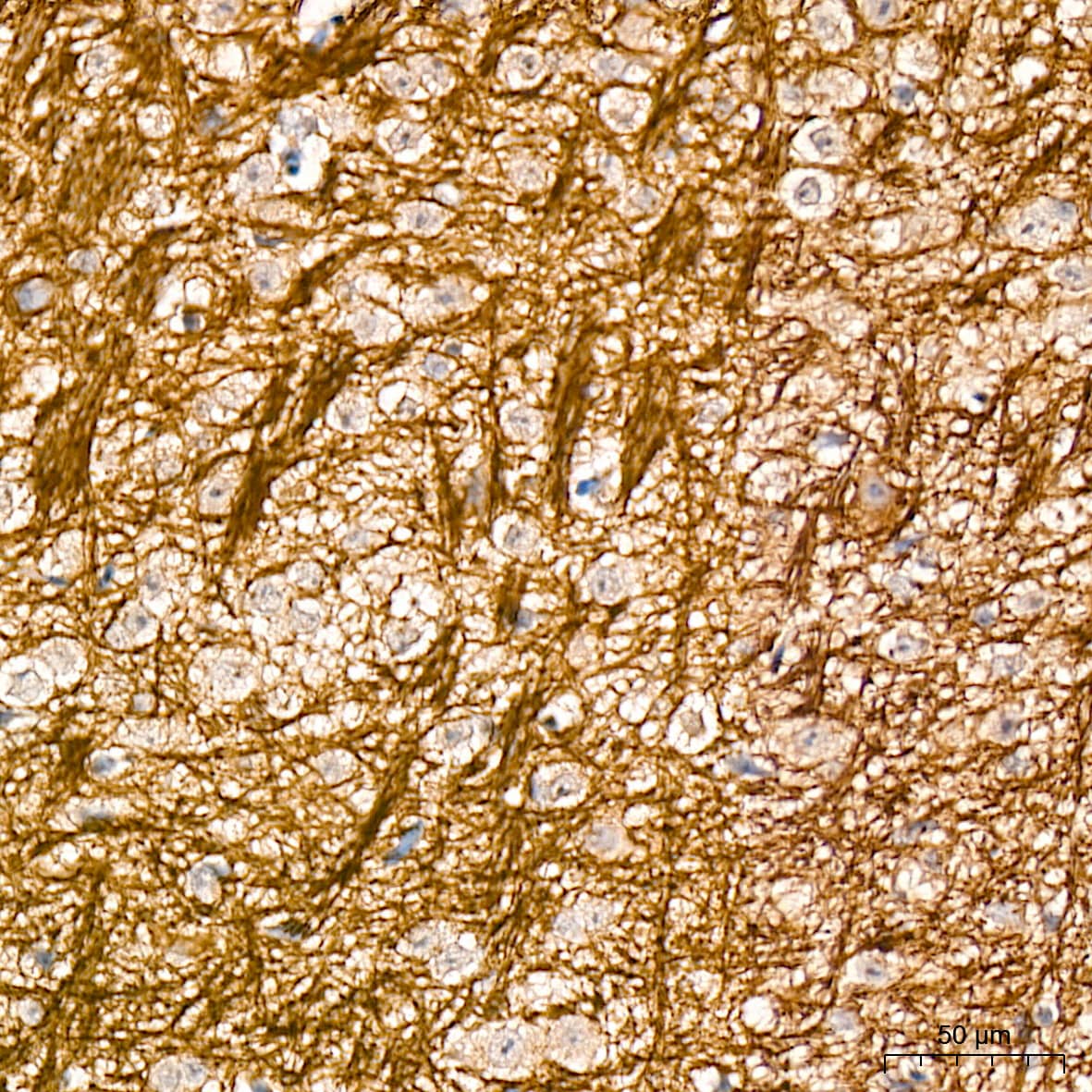 Immunohistochemistry: alpha-Internexin Antibody (5E5Z3) [NBP3-16230] - Immunohistochemistry analysis of alpha-Internexin in paraffin-embedded mouse brain tissue using alpha-Internexin Rabbit mAb  at a dilution of 1:200 (40x lens). High pressure antigen retrieval was performed with 0.01 M citrate buffer (pH 6.0) prior to IHC staining.