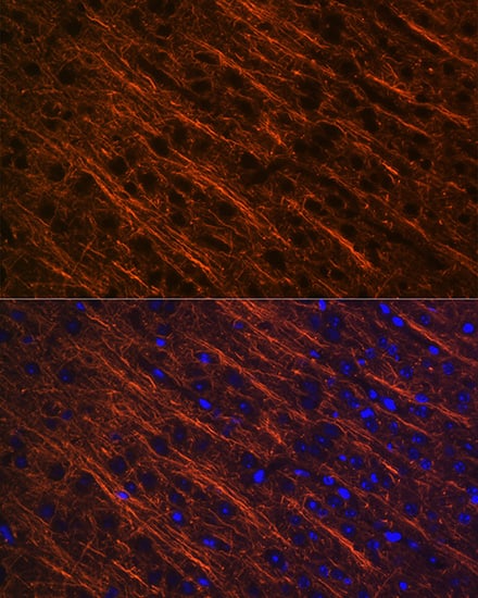Immunocytochemistry/ Immunofluorescence: alpha-Internexin Antibody (5E5Z3) [NBP3-16230] - Immunofluorescence analysis of paraffin-embedded mouse brain using alpha-Internexin Rabbit mAb  at dilution of 1:100 (40x lens). Secondary antibody: Cy3 Goat Anti-Rabbit IgG (H+L)  at 1:500 dilution. Blue: DAPI for nuclear staining.