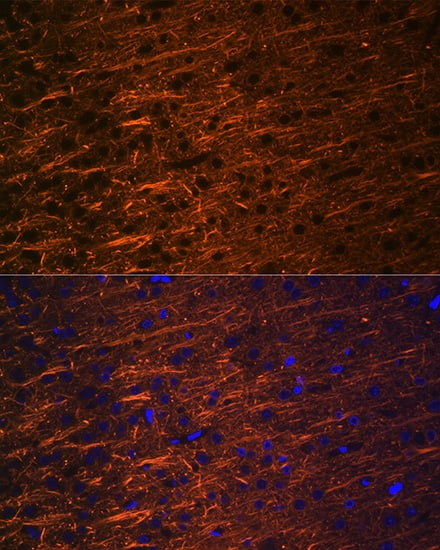 Immunocytochemistry/ Immunofluorescence: alpha-Internexin Antibody (5E5Z3) [NBP3-16230] - Immunofluorescence analysis of paraffin-embedded rat brain using alpha-Internexin Rabbit mAb  at dilution of 1:100 (40x lens). Secondary antibody: Cy3 Goat Anti-Rabbit IgG (H+L)  at 1:500 dilution. Blue: DAPI for nuclear staining.