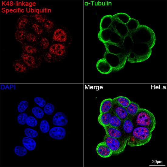 Immunocytochemistry/ Immunofluorescence: Poly-Ubiquitin Antibody (5Y8J0) - K48 Linkage [NBP3-16232] - Confocal imaging of MCF7 cells using Poly-Ubiquitin Rabbit mAb  followed by a further incubation with Cy3 Goat Anti-Rabbit IgG (H+L).The cells were counterstained with alpha-Tubulin Mouse mAb followed by incubation with ABflo(R) 488-conjugated Goat Anti-Mouse IgG (H+L) Ab (Green).DAPI was used for nuclear staining (Blue). Objective: 100x.