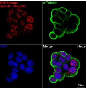 Immunocytochemistry/Immunofluorescence: Poly-Ubiquitin Antibody (5Y8J0) - K48 Linkage [NBP3-16232] - Confocal imaging of MCF7 cells using K48-linkage Specific Ubiquitin Rabbit mAb (dilution 1:100) followed by a further incubation with Cy3 Goat Anti-Rabbit IgG (H+L) (dilution 1:500)(Red).The cells were counterstained with  alpha -Tubulin Mouse mAb (dilution 1:400) followed by incubation with ABflo® 488-conjugated Goat Anti-Mouse IgG (H+L) Ab (dilution 1:500) (Green).DAPI was used for nuclear staining (Blue). Objective: 100x.