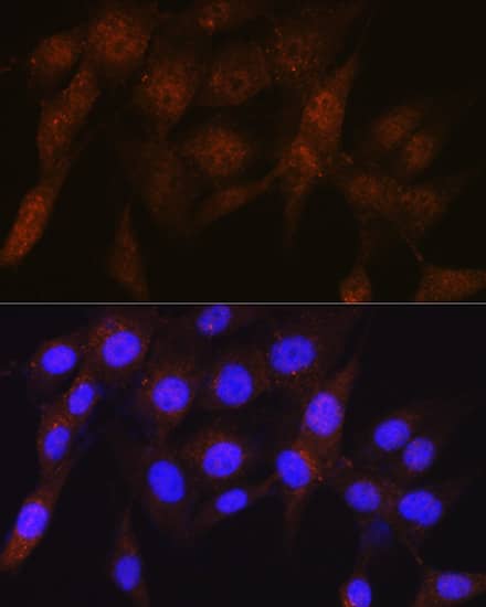 Immunocytochemistry/ Immunofluorescence: S5a/Angiocidin Antibody (5G1X6) [NBP3-16240] - Immunofluorescence analysis of NIH-3T3 cells using S5a/Angiocidin Rabbit mAb at dilution of 1:100 (40x lens). Secondary antibody: Cy3 Goat Anti-Rabbit IgG (H+L) at 1:500 dilution. Blue: DAPI for nuclear staining.