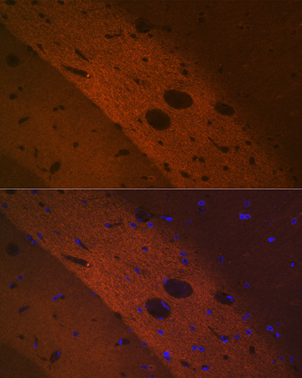 Immunocytochemistry/ Immunofluorescence: mGluR2 Antibody (0U6B5) [mGluR2] - Immunofluorescence analysis of rat brain using mGluR2 Rabbit mAb  at dilution of 1:100 (40x lens). Blue: DAPI for nuclear staining.