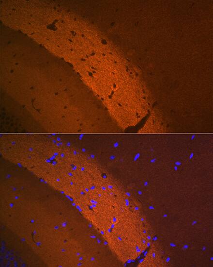 Immunocytochemistry/ Immunofluorescence: mGluR2 Antibody (0U6B5) [NBP3-16243] - Immunofluorescence analysis of mouse brain using mGluR2 Rabbit mAb  at dilution of 1:100 (40x lens). Blue: DAPI for nuclear staining.