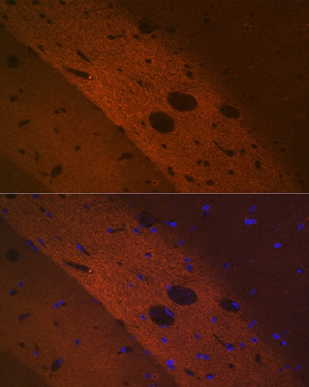 Immunocytochemistry/ Immunofluorescence: mGluR2 Antibody (0U6B5) [NBP3-16243] - Immunofluorescence analysis of rat brain using mGluR2 Rabbit mAb  at dilution of 1:100 (40x lens). Blue: DAPI for nuclear staining.