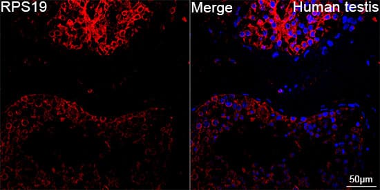 Immunocytochemistry/ Immunofluorescence RPS19 Antibody (4V3S7)