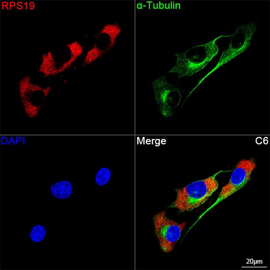 Immunocytochemistry/ Immunofluorescence RPS19 Antibody (4V3S7)