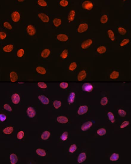 Immunocytochemistry/ Immunofluorescence U1A Antibody (8I3P5)