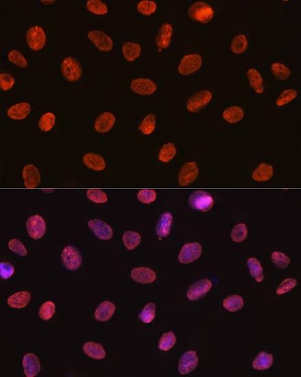 Immunocytochemistry/ Immunofluorescence: U1A Antibody (8I3P5) [U1A] - Immunofluorescence analysis of U-2 OS cells using U1A Rabbit mAb  at dilution of 1:100 (40x lens). Secondary antibody: Cy3 Goat Anti-Rabbit IgG (H+L)  at 1:500 dilution. Blue: DAPI for nuclear staining.
