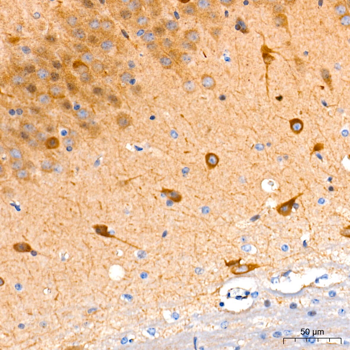 Immunohistochemistry: Guanylyl Cyclase beta 1 Antibody (5O8D9) [NBP3-16248] - Immunohistochemistry analysis of paraffin-embedded Mouse brain tissue using Guanylyl Cyclase beta 1 Rabbit mAb at a dilution of 1:200 (40x lens). High pressure antigen retrieval performed with 0.01M Tris-EDTA Buffer (pH 9.0) prior to IHC staining.