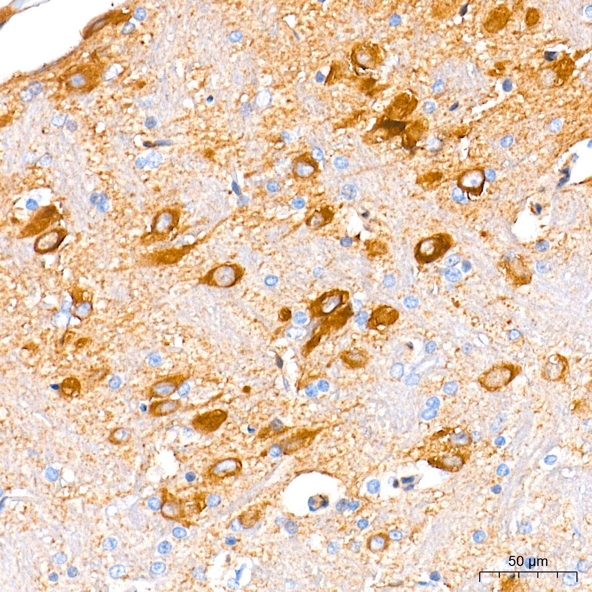 Immunohistochemistry: Guanylyl Cyclase beta 1 Antibody (5O8D9) [NBP3-16248] - Immunohistochemistry analysis of paraffin-embedded Rat brain tissue using Guanylyl Cyclase beta 1 Rabbit mAb at a dilution of 1:200 (40x lens). High pressure antigen retrieval performed with 0.01M Tris-EDTA Buffer (pH 9.0) prior to IHC staining.