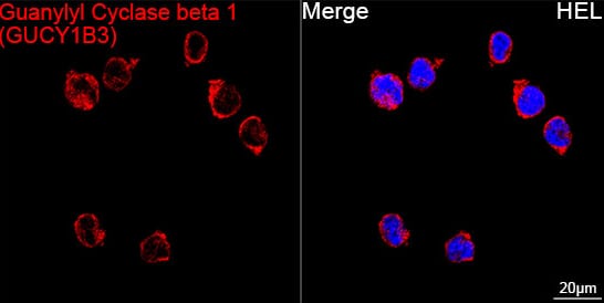 Immunocytochemistry/ Immunofluorescence Guanylyl Cyclase beta 1 Antibody (5O8D9)