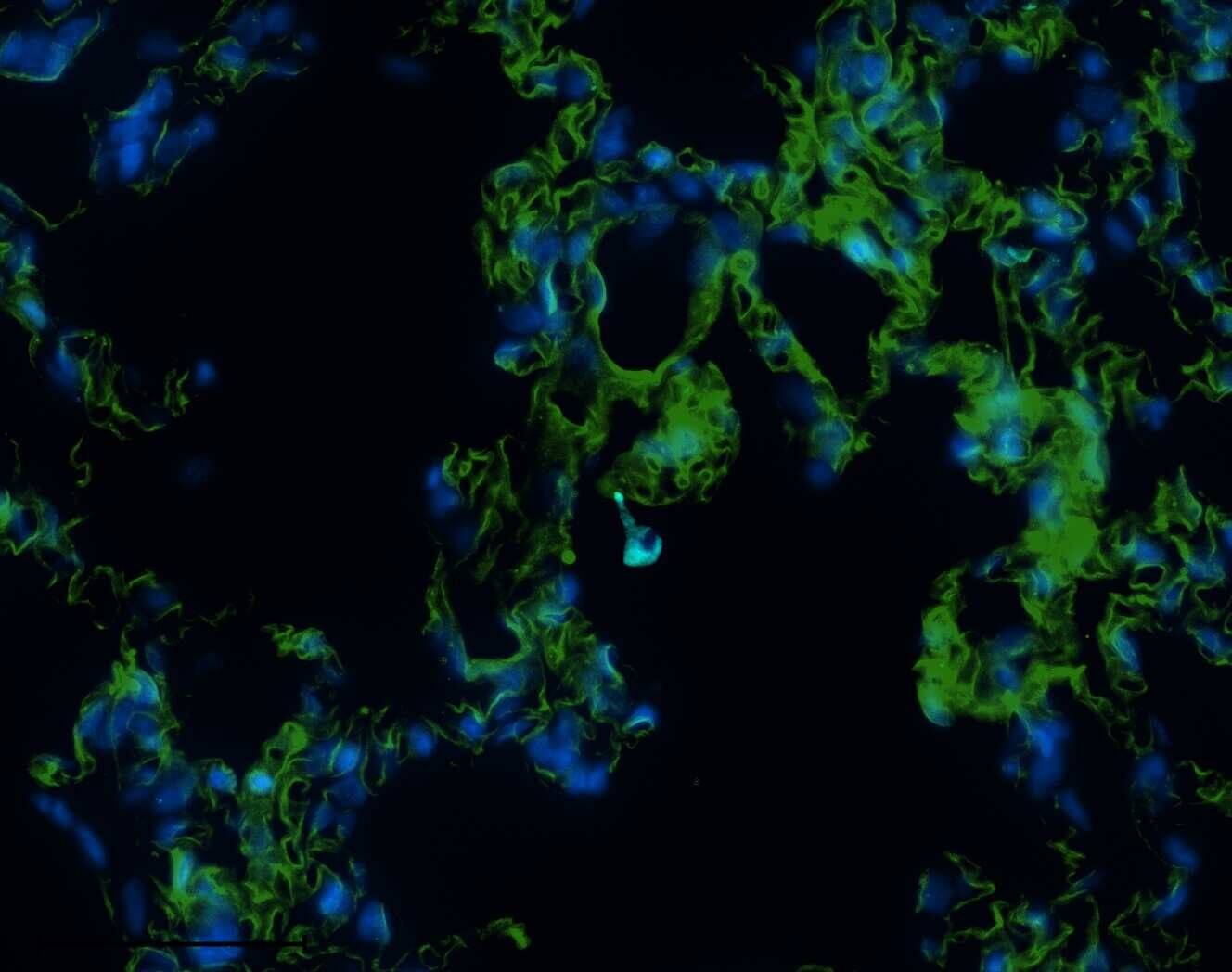 Immunohistochemistry-Paraffin Guanylyl Cyclase beta 1 Antibody (5O8D9)