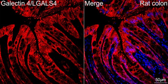 Immunocytochemistry/ Immunofluorescence: Galectin-4 Antibody (9Z2B5) [NBP3-16249] - Confocal imaging of paraffin-embedded Rat colon tissue using Galectin-4 Rabbit mAb followed by a further incubation with Cy3 Goat Anti-Rabbit IgG (H+L) . DAPI was used for nuclear staining (Blue). Objective: 40x. Perform high pressure antigen retrieval with 0.01 M citrate buffer (pH 6.0) prior to IF staining.