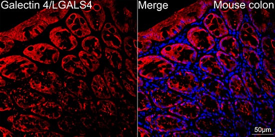 Immunocytochemistry/ Immunofluorescence: Galectin-4 Antibody (9Z2B5) [NBP3-16249] - Confocal imaging of paraffin-embedded Mouse colon tissue using Galectin-4 Rabbit mAb followed by a further incubation with Cy3 Goat Anti-Rabbit IgG (H+L) . DAPI was used for nuclear staining (Blue). Objective: 40x. Perform high pressure antigen retrieval with 0.01 M citrate buffer (pH 6.0) prior to IF staining.