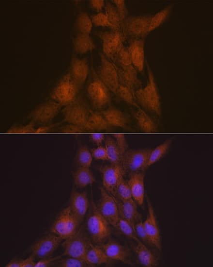 Immunocytochemistry/ Immunofluorescence: LIS1 Antibody (9O6X3) [NBP3-16253] - Immunofluorescence analysis of C6 cells using LIS1 Rabbit mAb  at dilution of 1:100 (40x lens). Secondary antibody: Cy3 Goat Anti-Rabbit IgG (H+L)  at 1:500 dilution. Blue: DAPI for nuclear staining.