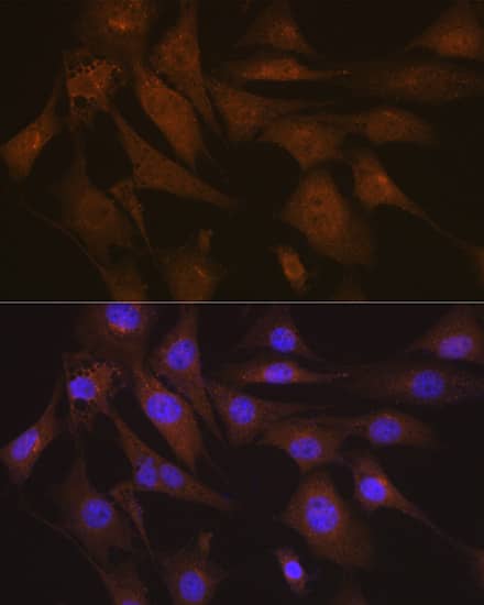Immunocytochemistry/ Immunofluorescence: LIS1 Antibody (9O6X3) [NBP3-16253] - Immunofluorescence analysis of NIH-3T3 cells using LIS1 Rabbit mAb  at dilution of 1:100 (40x lens). Secondary antibody: Cy3 Goat Anti-Rabbit IgG (H+L)  at 1:500 dilution. Blue: DAPI for nuclear staining.