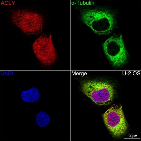 Immunocytochemistry/ Immunofluorescence: ATP Citrate Lyase Antibody (8A0V0) [NBP3-16261] - Confocal imaging of U-2 OS cells using ATP Citrate Lyase Rabbit mAb. The cells were counterstained with alpha-Tubulin Mouse mAb (Green). DAPI was used for nuclear staining (blue). Objective: 100x.