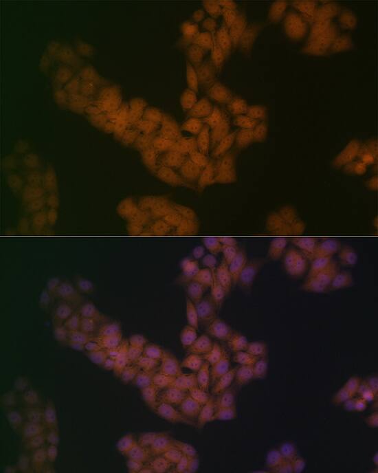 Immunocytochemistry/ Immunofluorescence: BANF1 Antibody (6J8O2) [NBP3-16263] - Immunofluorescence analysis of HeLa cells using BANF1 Rabbit mAb at dilution of 1:100 (40x lens). Secondary antibody: Cy3-conjugated Goat anti-Rabbit IgG (H+L) at 1:500 dilution. Blue: DAPI for nuclear staining.