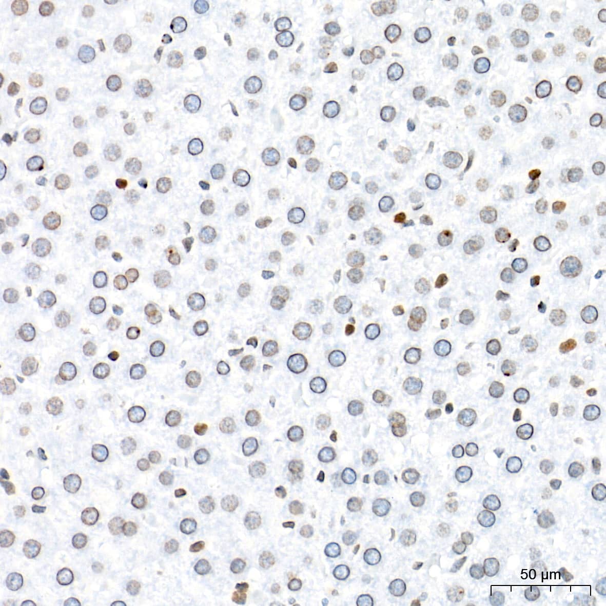 Immunohistochemistry: BANF1 Antibody (6J8O2) [NBP3-16263] - Immunohistochemistry analysis of paraffin-embedded Rat liver tissue using BANF1 Rabbit mAb at a dilution of 1:500 (40x lens). High pressure antigen retrieval performed with 0.01M Tris-EDTA Buffer (pH 9.0) prior to IHC staining.