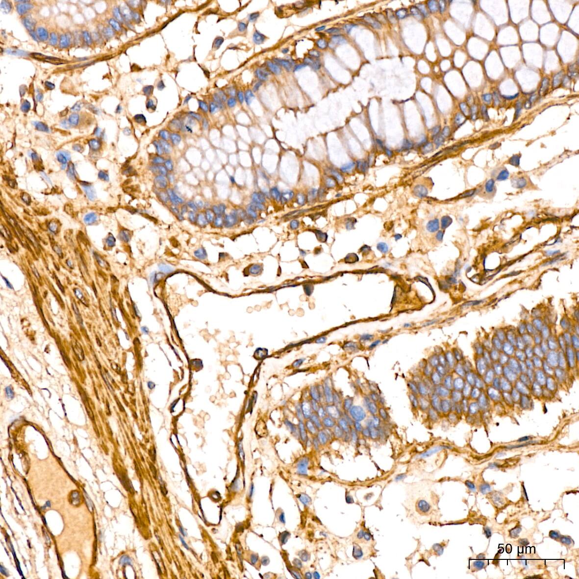 Immunohistochemistry: Filamin A Antibody (3X8Y9) [NBP3-16266] - Immunohistochemistry analysis of paraffin-embedded Human colon tissue using Filamin A Rabbit mAb at a dilution of 1:400 (40x lens). High pressure antigen retrieval performed with 0.01M Citrate Bufferr (pH 6.0) prior to IHC staining.