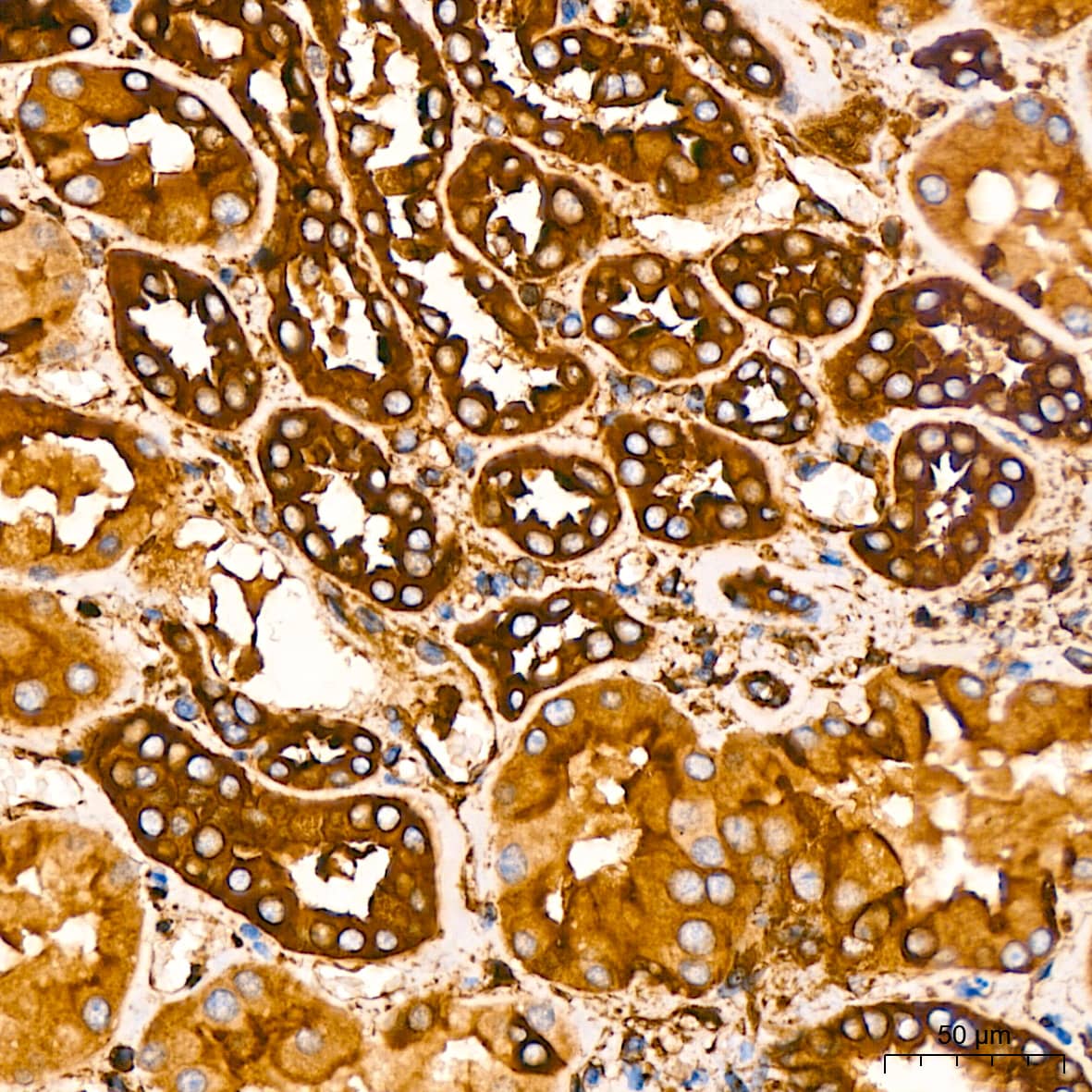 Immunohistochemistry: Filamin A Antibody (3X8Y9) [NBP3-16266] - Immunohistochemistry analysis of paraffin-embedded Human kidney tissue using Filamin A Rabbit mAb at a dilution of 1:200 (40x lens). High pressure antigen retrieval performed with 0.01M Tris-EDTA Buffer (pH 9.0) prior to IHC staining.