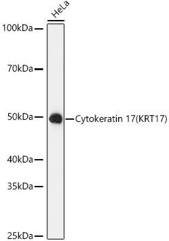 Western Blot: Cytokeratin 17 Antibody (9O6X9) [NBP3-16271] - Western blot analysis of lysates from HeLa cells, using Cytokeratin 17 Rabbit mAb at 1:1000 dilution.Secondary antibody: HRP-conjugated Goat anti-Rabbit IgG (H+L) at 1:10000 dilution.Lysates/proteins: 25ug per lane.Blocking buffer: 3% nonfat dry milk in TBST.Detection: ECL Basic Kit.Exposure time: 90s.
