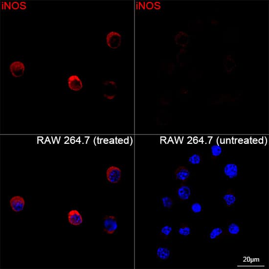 Immunocytochemistry/ Immunofluorescence: iNOS Antibody (3L0U6) [NBP3-16273] - Confocal imaging of RAW 264.7 cells (treated with LPS) and RAW 264.7 cells(untreated) using iNOS Rabbit mAb  followed by a further incubation with Cy3 Goat Anti-Rabbit IgG (H+L) . DAPI was used for nuclear staining (Blue). Objective: 100x.