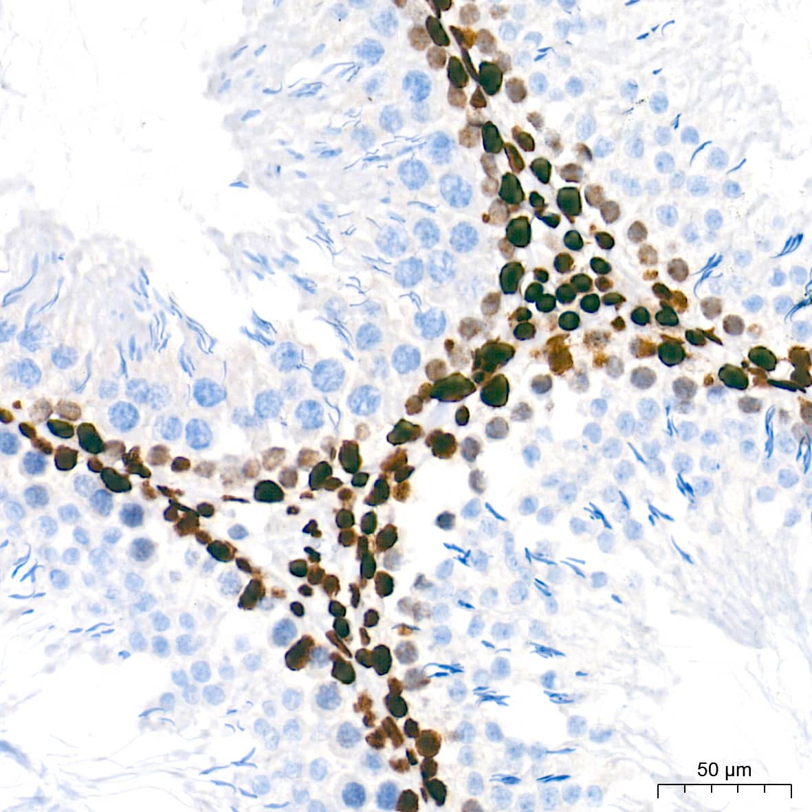 Immunohistochemistry: NONO Antibody (0V0N8) [NBP3-16276] - Immunohistochemistry analysis of paraffin-embedded Rat testis tissue using NONO Rabbit mAb at a dilution of 1:500 (40x lens). High pressure antigen retrieval performed with 0.01M Tris-EDTA Buffer (pH 9.0) prior to IHC staining.