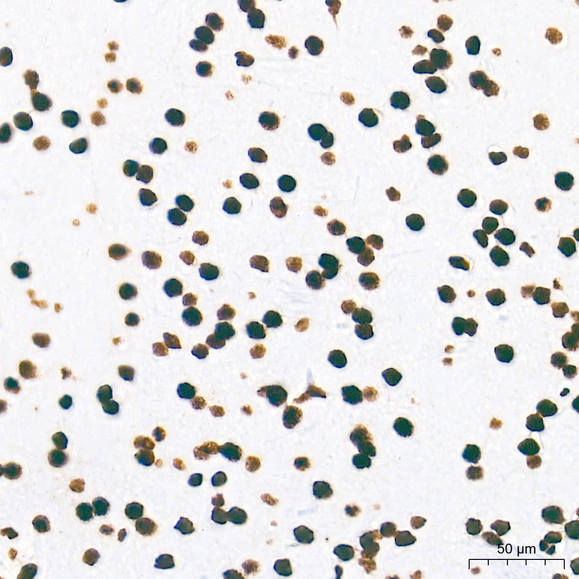 Immunohistochemistry: NONO Antibody (0V0N8) [NBP3-16276] - Immunohistochemistry analysis of paraffin-embedded Rat brain tissue using NONO Rabbit mAb at a dilution of 1:500 (40x lens). High pressure antigen retrieval performed with 0.01M Tris-EDTA Buffer (pH 9.0) prior to IHC staining.