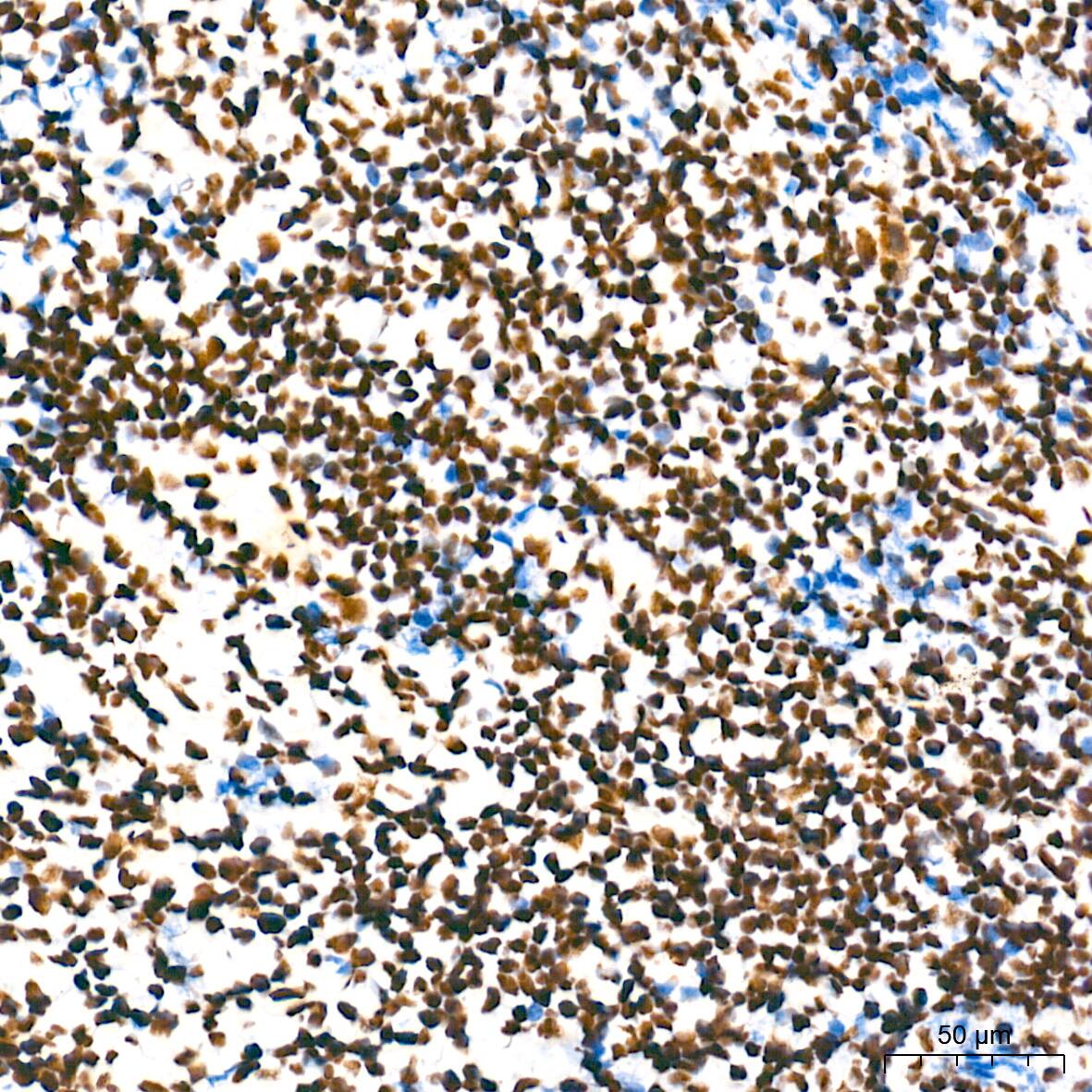 Immunohistochemistry: NONO Antibody (0V0N8) [NBP3-16276] - Immunohistochemistry analysis of paraffin-embedded Human tonsil tissue using NONO Rabbit mAb at a dilution of 1:500 (40x lens). High pressure antigen retrieval performed with 0.01M Tris-EDTA Buffer (pH 9.0) prior to IHC staining.