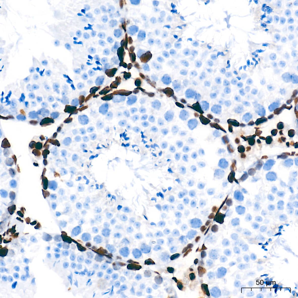 Immunohistochemistry: NONO Antibody (0V0N8) [NONO] - Immunohistochemistry analysis of paraffin-embedded Mouse testis tissue using NONO Rabbit mAb  at a dilution of 1:500 (40x lens). High pressure antigen retrieval performed with 0.01M Tris-EDTA Buffer (pH 9.0) prior to IHC staining.