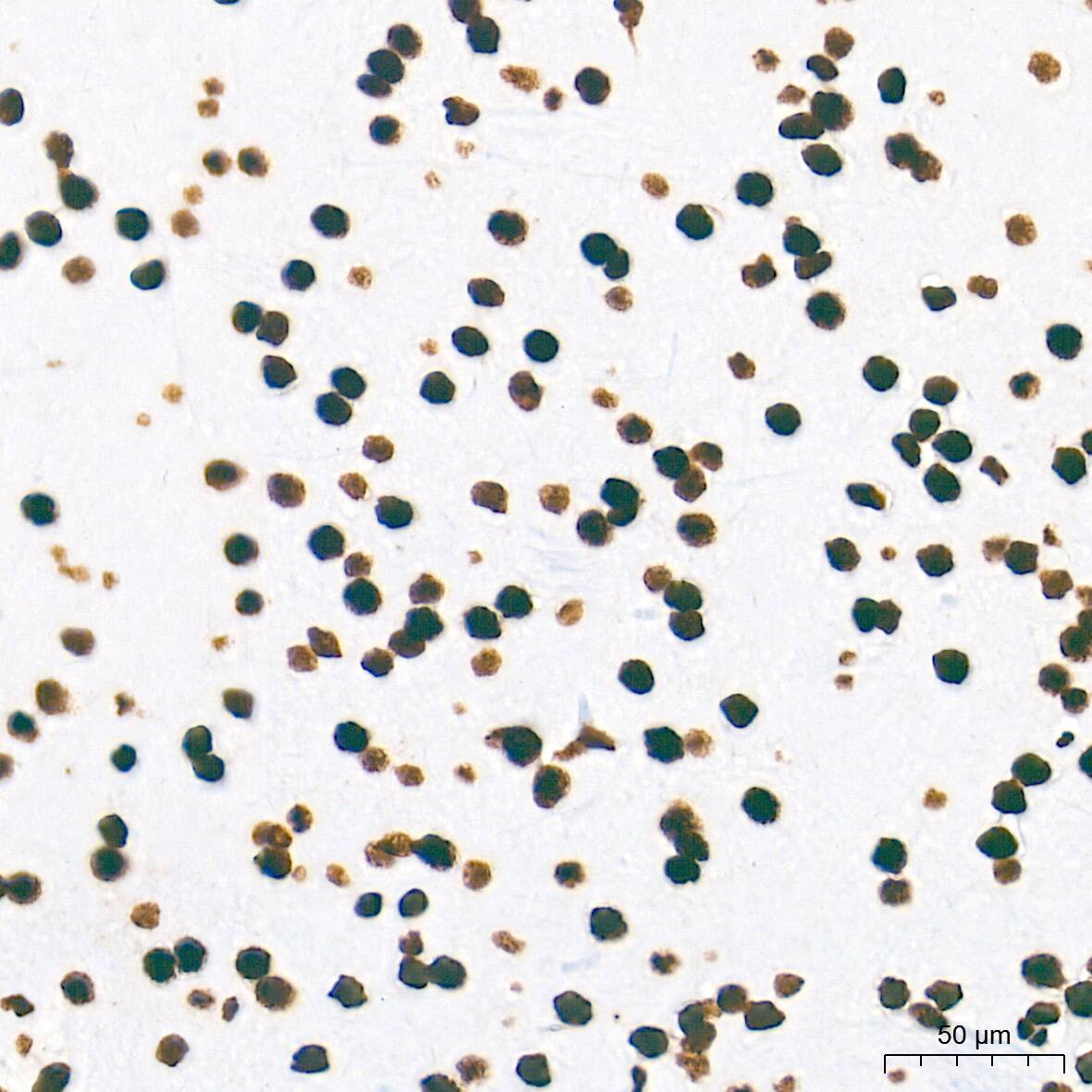 Immunohistochemistry: NONO Antibody (0V0N8) [NONO] - Immunohistochemistry analysis of paraffin-embedded Rat brain tissue using NONO Rabbit mAb  at a dilution of 1:500 (40x lens). High pressure antigen retrieval performed with 0.01M Tris-EDTA Buffer (pH 9.0) prior to IHC staining.