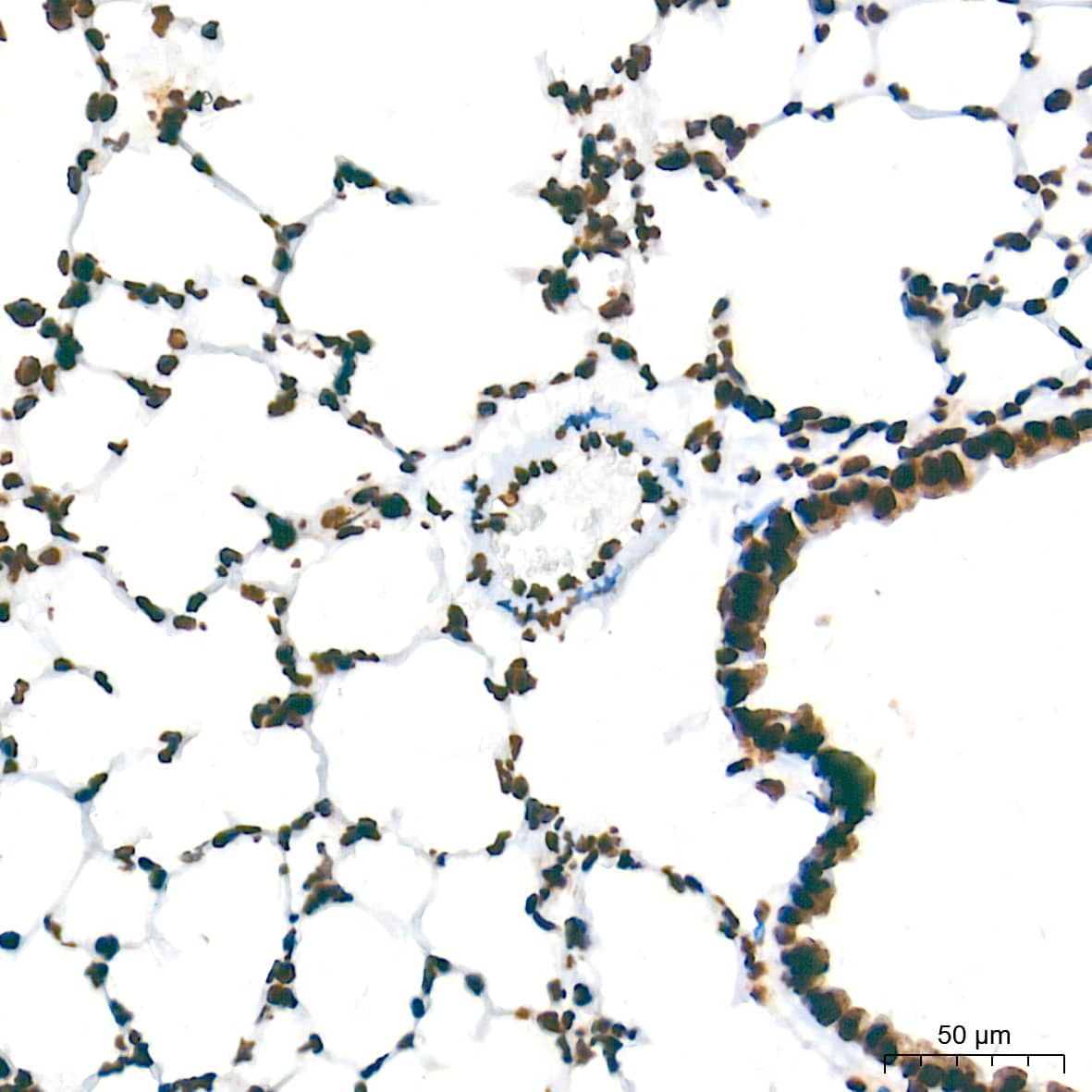 Immunohistochemistry: NONO Antibody (0V0N8) [NONO] - Immunohistochemistry analysis of paraffin-embedded Mouse lung tissue using NONO Rabbit mAb  at a dilution of 1:500 (40x lens). High pressure antigen retrieval performed with 0.01M Tris-EDTA Buffer (pH 9.0) prior to IHC staining.