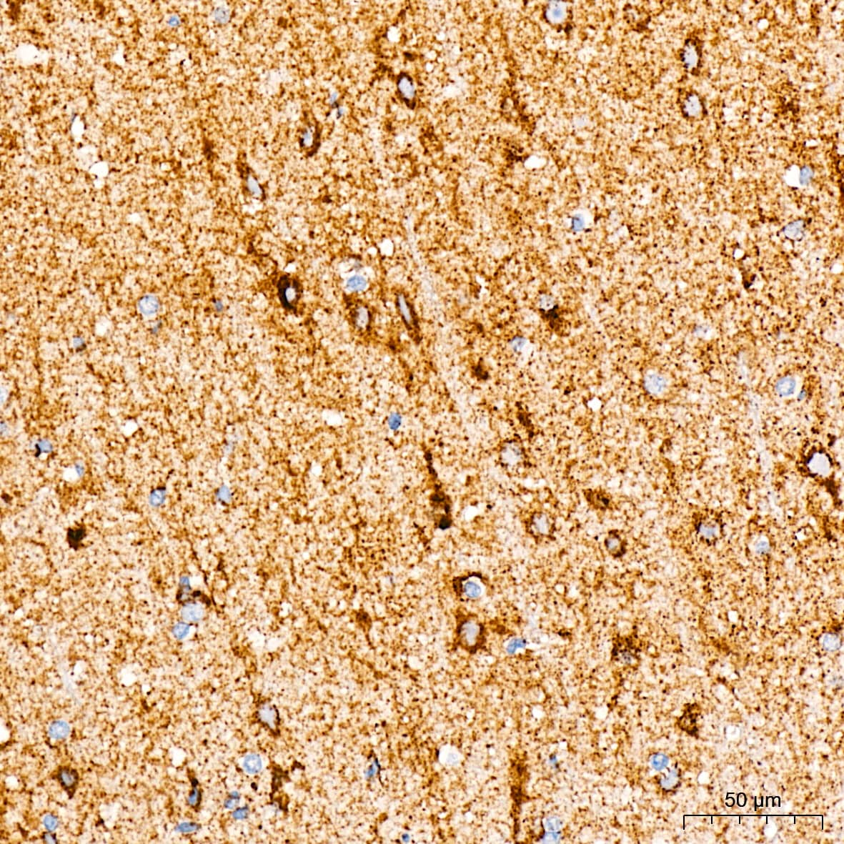 Immunohistochemistry: MT-CO2 Antibody (6H0N5) [NBP3-16283] - Immunohistochemistry analysis of paraffin-embedded Human brain tissue using MT-CO2 Rabbit mAb at a dilution of 1:200 (40x lens). High pressure antigen retrieval was performed with 0.01 M citrate buffer (pH 6.0) prior to IHC staining.