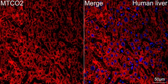 Immunocytochemistry/ Immunofluorescence: MT-CO2 Antibody (6H0N5) [NBP3-16283] - Confocal imaging of paraffin-embedded Human liver tissue using MT-CO2 Rabbit mAb followed by a further incubation with Cy3 Goat Anti-Rabbit IgG (H+L) . DAPI was used for nuclear staining (Blue). Objective: 40x. Perform high pressure antigen retrieval with 0.01 M citrate buffer (pH 6.0) prior to IF staining.