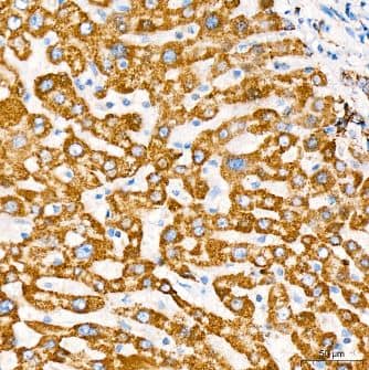 Immunohistochemistry-Paraffin: MT-CO2 Antibody (6H0N5) [NBP3-16283] - Human liver tissue using MTCO2 Rabbit mAb at a dilution of 1:200 (40x lens). High pressure antigen retrieval was performed with 0.01 M citrate buffer (pH 6.0) prior to IHC staining.