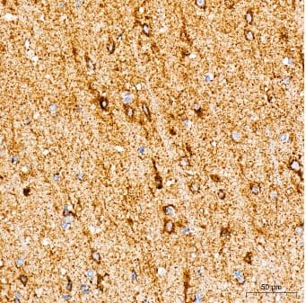 Immunohistochemistry-Paraffin: MT-CO2 Antibody (6H0N5) [NBP3-16283] - Human brain tissue using MTCO2 Rabbit mAb at a dilution of 1:200 (40x lens). High pressure antigen retrieval was performed with 0.01 M citrate buffer (pH 6.0) prior to IHC staining.