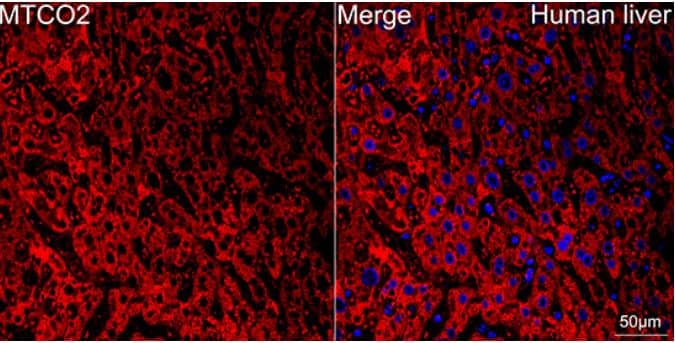 Immunohistochemistry-Paraffin: MT-CO2 Antibody (6H0N5) [NBP3-16283] -Confocal imaging of paraffin-embedded Human liver tissue using MTCO2 Rabbit mAb (dilution 1:200) followed by a further incubation with Cy3 Goat Anti-Rabbit IgG (H+L) (dilution 1:500) (Red). DAPI was used for nuclear staining (Blue). Objective: 40x. Perform high pressure antigen retrieval with 0.01 M citrate buffer (pH 6.0) prior to IF staining.